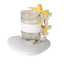 HERNIATED DISC SIMULATOR MODEL 4400