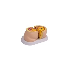 M50 OBEZİTE MODELİ