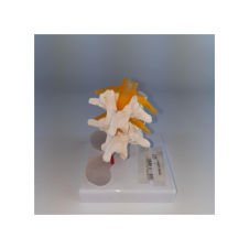 ERKENTMED L11 LOMBER MODELİ